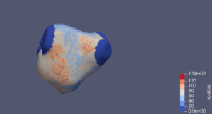 Cardiac MRI left atrial 3D scar mapping